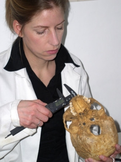Skeletal measurements